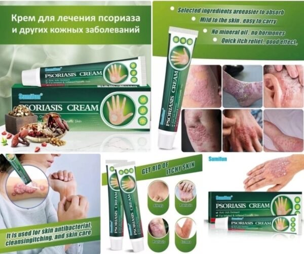 ⁦Sumifun Psoriasis Cream هو مرهم مضاد للحكة مصمم خصيصًا⁩ - الصورة ⁦2⁩