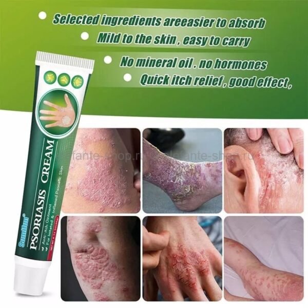 ⁦Sumifun Psoriasis Cream هو مرهم مضاد للحكة مصمم خصيصًا⁩ - الصورة ⁦3⁩
