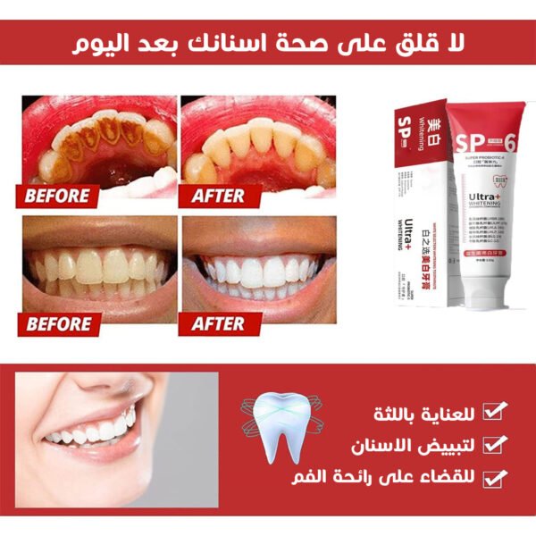 ⁦معجون أسنان Yayashi SP-4 Ultra Whitening⁩ - الصورة ⁦2⁩