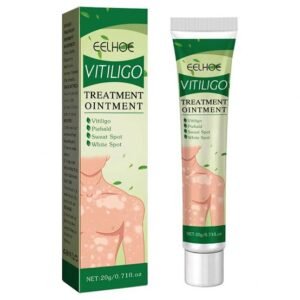 EELHOE VITILIGO TREATMENT