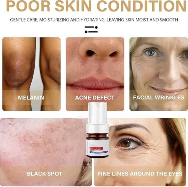 ⁦Aobenz Whitening and Freckle Removing Essence".⁩ - الصورة ⁦4⁩